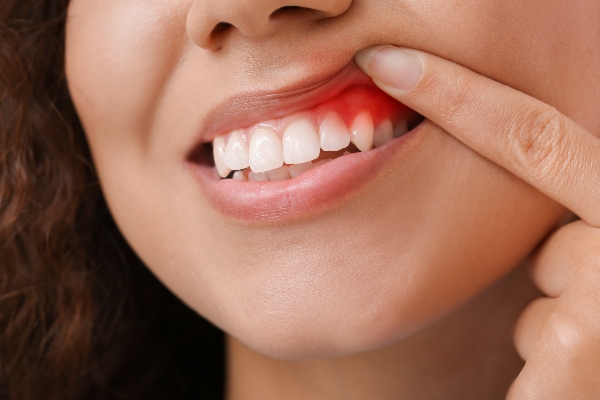 The Importance Of Periodontal Gum Disease Treatment